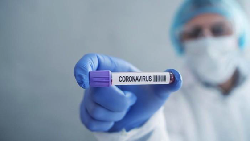 Bicara Pelan Diklaim Bisa Turunkan Risiko Penularan Corona, Kok Bisa?