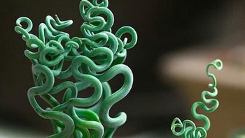 Ini Trachyandra, kalau kata netizen cocok banget buat Medusa. Foto: via Bored Panda