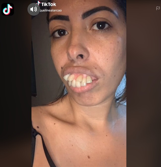 Lewat TikTok-nya, Jaqueline memperlihatkan sejumlah foto dengan gigi tonggos. Ia menyebut bahwa itu foto-foto throwback.  Foto: dok. TikTok, Instagram