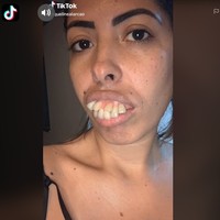 Lewat TikTok-nya, Jaqueline memperlihatkan sejumlah foto dengan gigi tonggos. Ia menyebut bahwa itu foto-foto throwback.  Foto: dok. TikTok, Instagram