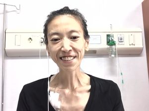 Menyayat Hati, YouTuber Posting Video Pamit Sebelum Meninggal Karena Kanker