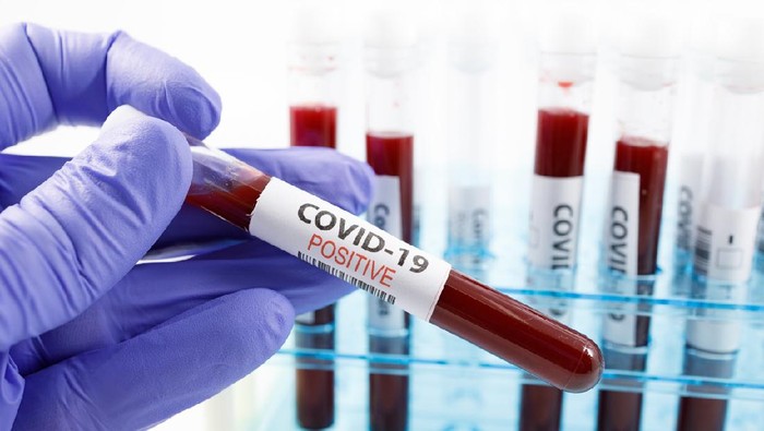 Corona Close up of microbiologist hand with surgical gloves holding a positive blood test result for coronavirus. Test tubes rack with blood sample for covid-19 virus, on white background with copy space.