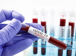Heboh Golongan Darah O Kebal COVID-19, Penelitinya Titip Pesan Penting
