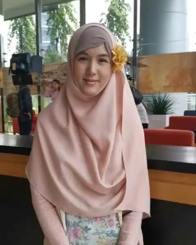 Aliza Kim merupakan mantan model kelahiran Oklahoma, Amerika Serikat. Dibesarkan di Boston, Aliza yang juga berdarah Thailand memutuskan menjadi mualaf pada 2013. Foto: instagram @alizakim