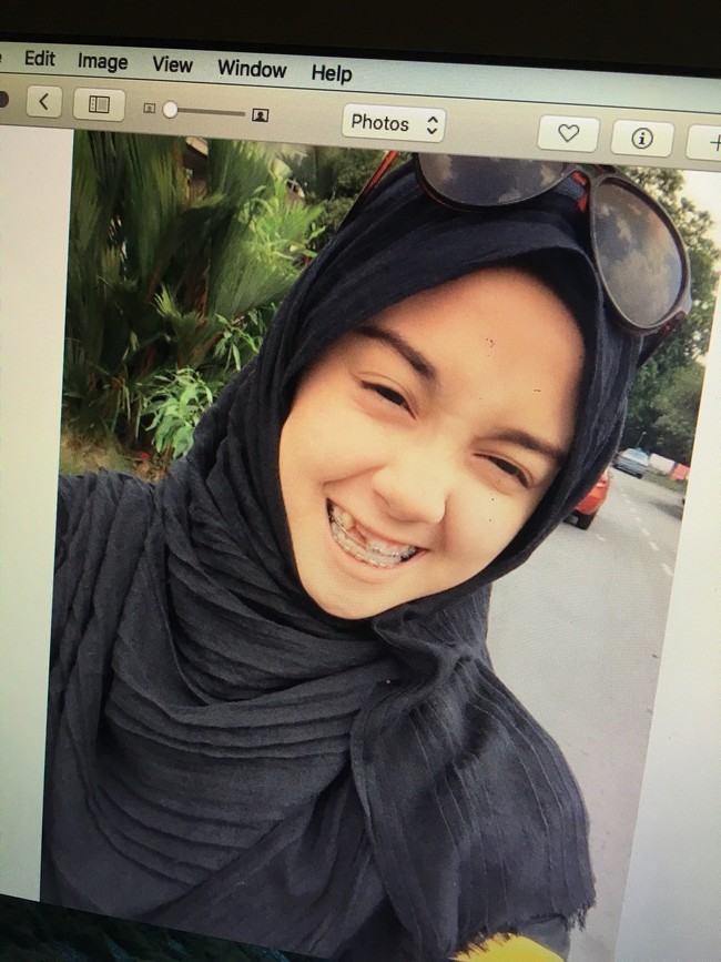 Nurin Afiqah Zulkifli menanggung derita selama sembilan tahun akibat ketidaksempurnaan gigi depannya dan ompong. Kini, Nurin bisa bernafas lega setelah berhasil menjalani operasi. Transformasi penampilannya pun membuat dirinya viral. Foto: Twitter