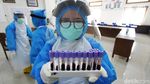 Pemkot Solo Gelar Rapid Test untuk Wartawan