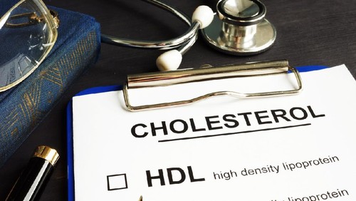 Good HDL and bad LDL cholesterol written on blackboard by unrecognizable doctor with stethoscope