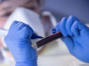 Biotek di China Uji Coba Obat Antibodi Corona ke Manusia