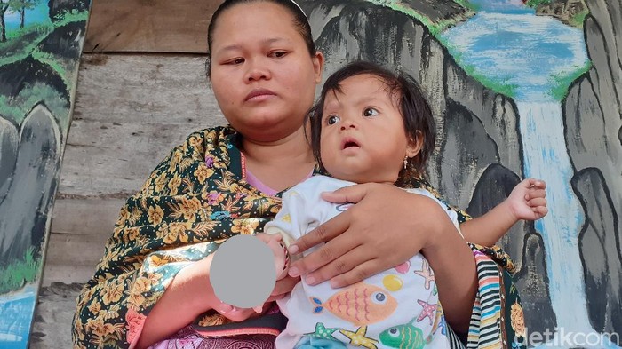 Tsamara Kumaira Mariba, balita di Sragen yang tangan kanannya infeksi usai digigit kutu kucing, Jumat (6/3/2020).