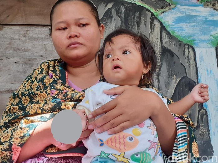 Tsamara Kumaira Mariba, balita di Sragen yang tangan kanannya infeksi usai digigit kutu kucing, Jumat (6/3/2020).