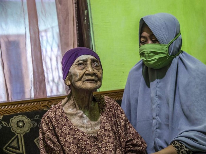 Seorang nenek berusia 100 tahun, Kamtim, sembuh dari COVID-19. Nenek asal Dusun Gendong, perbatasan Surabaya dan Gresik ini dinyatakan sembuh usai dirawat selama satu bulan di rumah sakit.