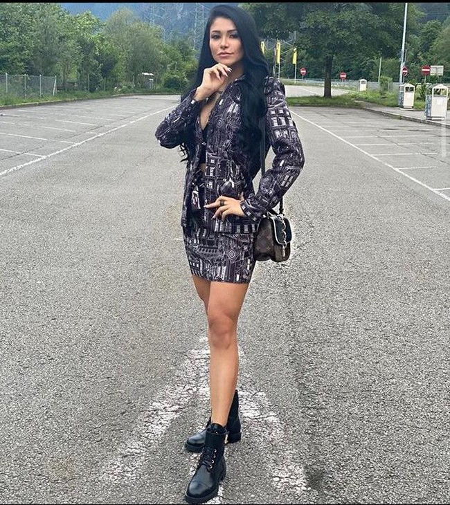 Model asal Brasil ini terobsesi operasi plastik dan percaya bahwa prosedur serta perubahan penampilannya membuat dirinya berhasil untuk kehidupan cintanya. Nathy pun menjelaskan bahwa operasi plastik yang dilakukannya juga membuat dirinya ingin semakin memperbaiki tubuhnya. (Foto: Instagram)