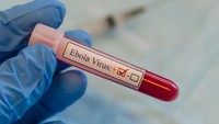 Wabah Virus Berbahaya 'Bangkit' Lagi di Negara Ini, 65 Orang Meninggal