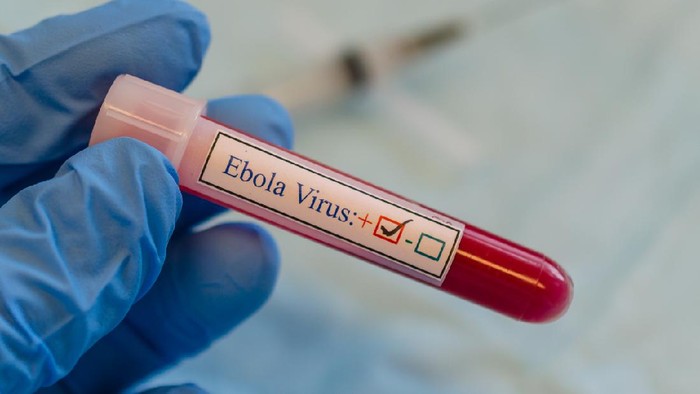 Korban Tewas Wabah Ebola di Uganda Naik Jadi 44 Orang