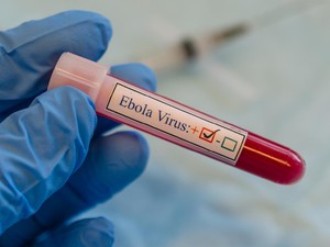 Virus Ebola Mewabah Lagi, WHO Akan Identifikasi Jenis Variannya