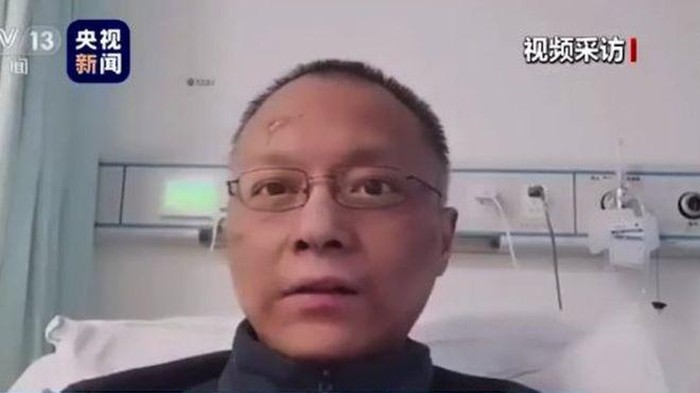 Dokter di China yang Kulitnya Jadi Hitam karena Corona Meninggal Dunia Dokter di China yang Kulitnya Jadi Hitam karena Corona Meninggal Dunia
