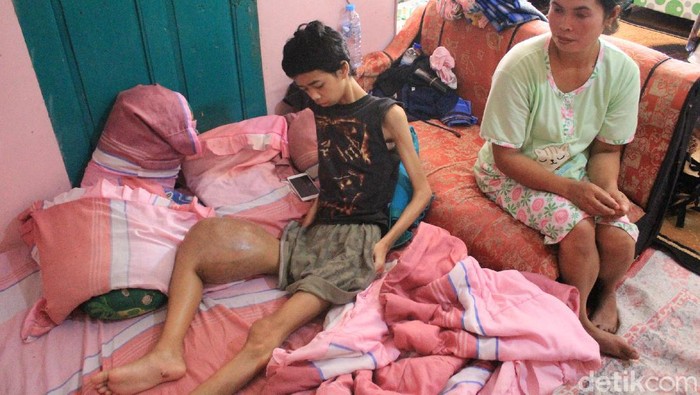 Pria di Kabupaten Bandung terkena tumor tulang.