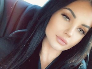 Terinspirasi Kim K, Pebalap yang Jadi Artis Porno Operasi Bokong Rp 200 Juta