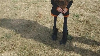 Benarkah kaki bocah ini begitu kecil? Coba dilihat lagi detikes. Foto: Brightside