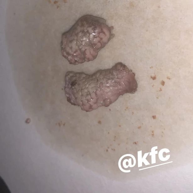 Temukan 'Otak' di Menu KFC, Wanita Ini Trauma hingga Mau Jadi Vegetarian
