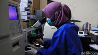 World Health Organization (WHO)melaporkan ada lebih dari 22.000 petugas medis yang tersebar di 52 negara dan wilayah dinyatakan telah terinfeksi Virus Corona.