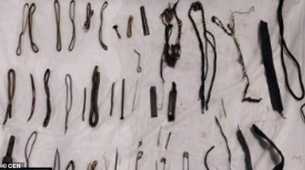 Penemuan benda nonmakanan dalam perut manusia