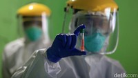 Sampel yang telah dikumpulkan disimpan di dalam tabung atau botol steril. Sampel lendir itu kemudian akan dikirim ke laboratoriun untuk dilakukan pengujian.