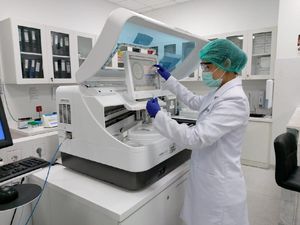 Mengenal Tes Serologi COVID-19 Berbasis Lab, Sensitivitas Diklaim 100 Persen