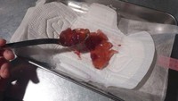 Hiii... jijik! selai stroberi ini disajikan di atas pembalut. Jadi mirip darah ketika seorang wanita sedang menstruasi. Foto: boredpanda.com