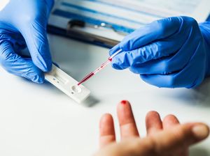 Mutasi Virus Corona Disebut Tak Secepat HIV dan Influenza