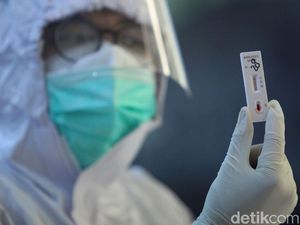 Tes Corona Mahal, Ombudsman Duga Ada Pihak yang Manfaatkan Situasi