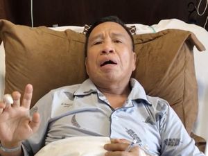 Membaik Usai Operasi Batu Empedu, Miing Bagito Sudah Pulang ke Rumah