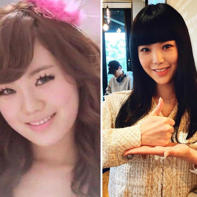 Lizzy Wajah Lizzy yang tergabung dalam girlband After School memang terlihat berubah dari awal debut hingga sekarang. Satu yang membedakan adalah pipinya lebih tirus sehingga wajahnya tampak lebih kecil. Penggemar pun menduga jika hal tersebut dikarenakan penurunan berat badan. Foto: Internet/Instagram