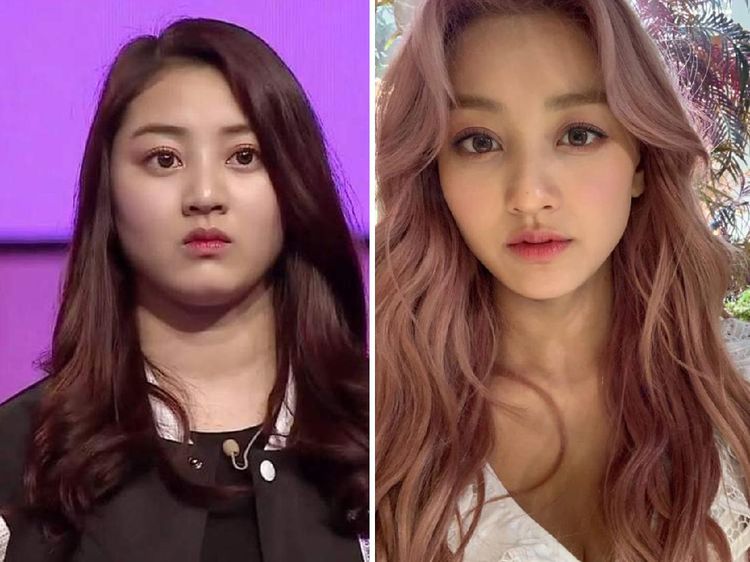 Perubahan Wajah Artis Korea Sebelum dan Sesudah Diet yang Bikin Pangling