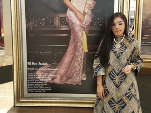 Pernah Jadi Pasien Face Off 16 Tahun Lalu, Begini Kondisi Lisa Sekarang