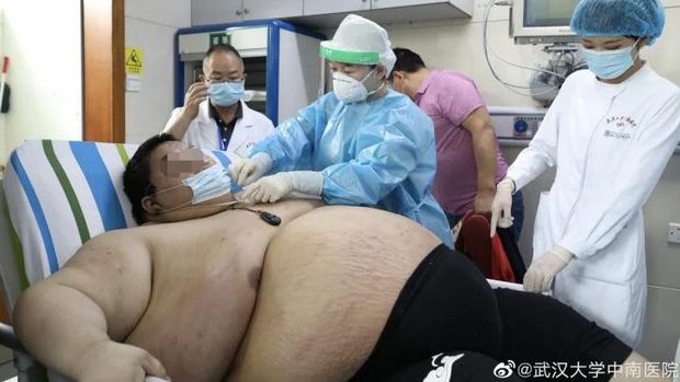 Zhou, pria obetitas yang berat badannya naik lebih dari 90 kg selama lockdown.