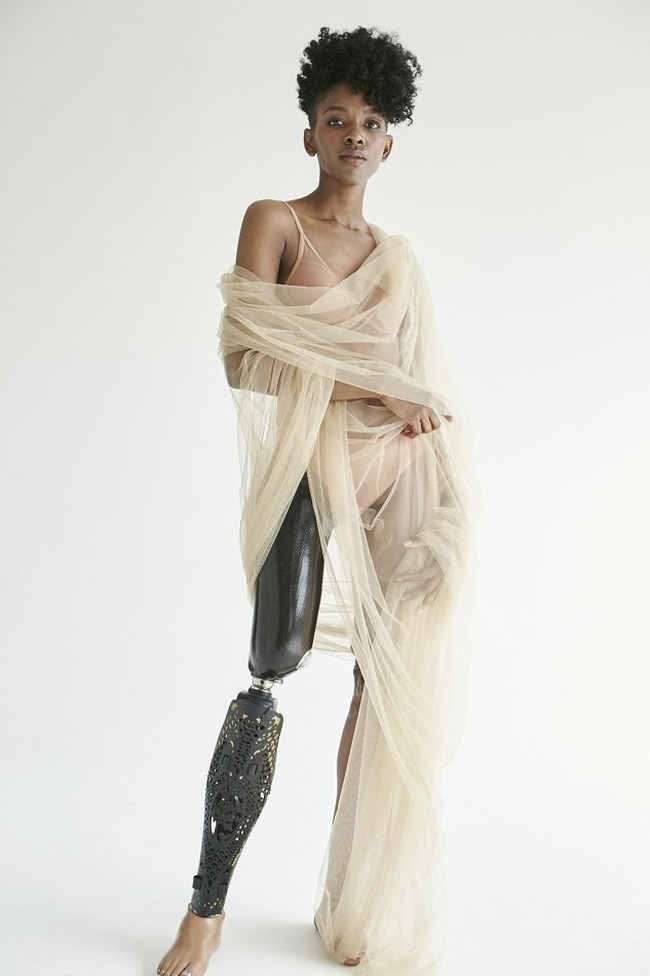 Kiara Marshall sukses menjadi model majalah setelah kehilangan sebelah kakinya akibat kecelakaan lalu lintas. Pada 2003, Kiara yang saat itu baru berusia 10 tahun, ditabrak oleh seorang pengemudi yang sedang mabuk. Insiden tersebut membuatnya terpaksa kehilangan kaki kanan karena cedera parah hingga harus diamputasi. Foto: dok. Kiara Marshall/Metro