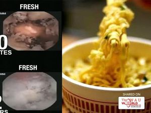 Cara Mudah Bersihkan Dispenser hingga Proses Pencernaan Mie Instan di Perut