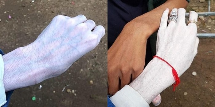 Perbedaab sebelum dan setelah menggunakan krim pemutih