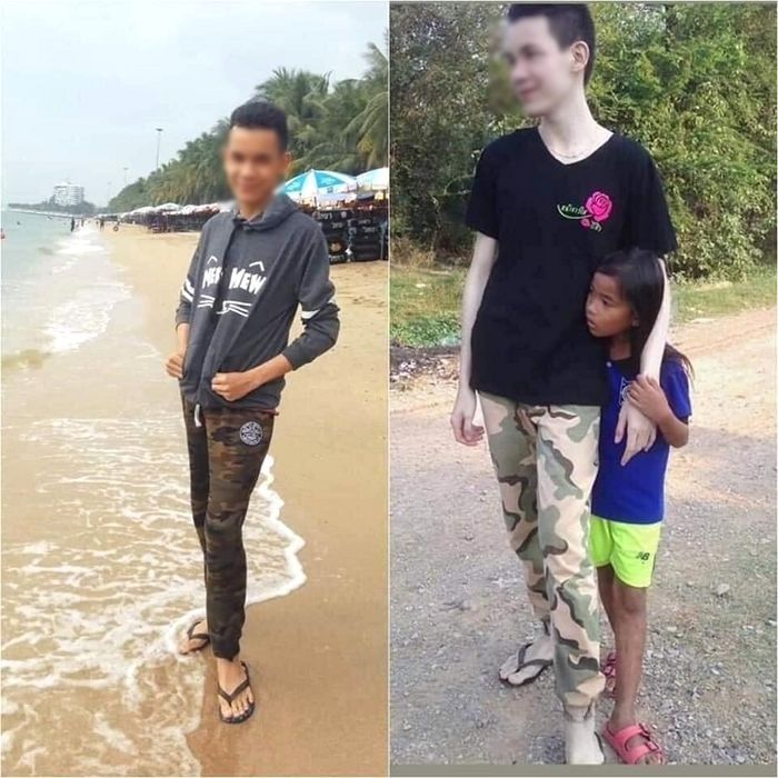 Perbedaab sebelum dan setelah menggunakan krim pemutih