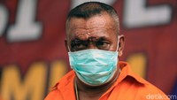 Salah seorang tersangka terluka pada pelipisnya dan belum diketahui penyebabnya.
