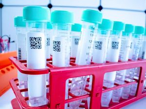 BIN Gelar Tes Swab Massal di Karawang, 3 Nakes dan 5 Warga Positif Corona