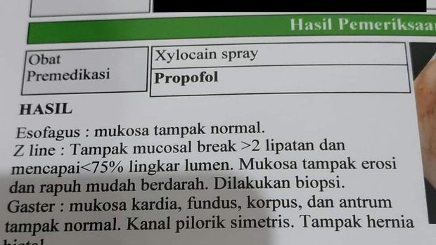tak boleh makan mie instan