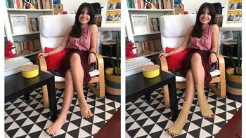 Diganti dengan kaki orang lain. Foto: James Fridman