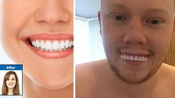 Pesan gigi palsu kok beda sama yang dpajang di onlineshop. (Foto: Boredpanda)