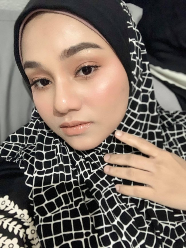 Tak lama setelah mengunggah ulang foto bersama bayi yang baru dilahirkannya itu, Amma kembali mengunggah foto penampilan wajahnya saat ini. Kedua foto tersebut jika dibandingkan memiliki perbedaan yang sangat jelas. Foto: Facebook Amma Malik