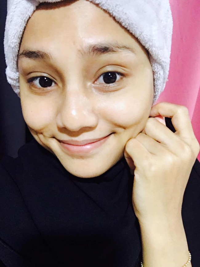 Untungnya setelah melahirkan wajah Amma bisa kembali seperti semula. Dengan demikian, dirinya bisa menjadi kembali percaya diri untuk memposting foto-fotonya di media sosial. Foto: Facebook Amma Malik