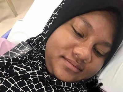 Foto Perubahan Drastis Wajah Wanita Saat Hamil Vs Usai Melahirkan