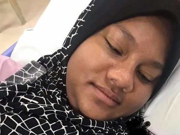 Foto Perubahan Drastis Wajah Wanita Saat Hamil Vs Usai Melahirkan
