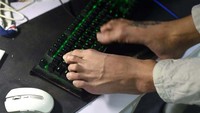 Jin Jiangwei biasa mengontrol mouse dengan kakinya untuk mencetak tanda terima dari toko online-nya.